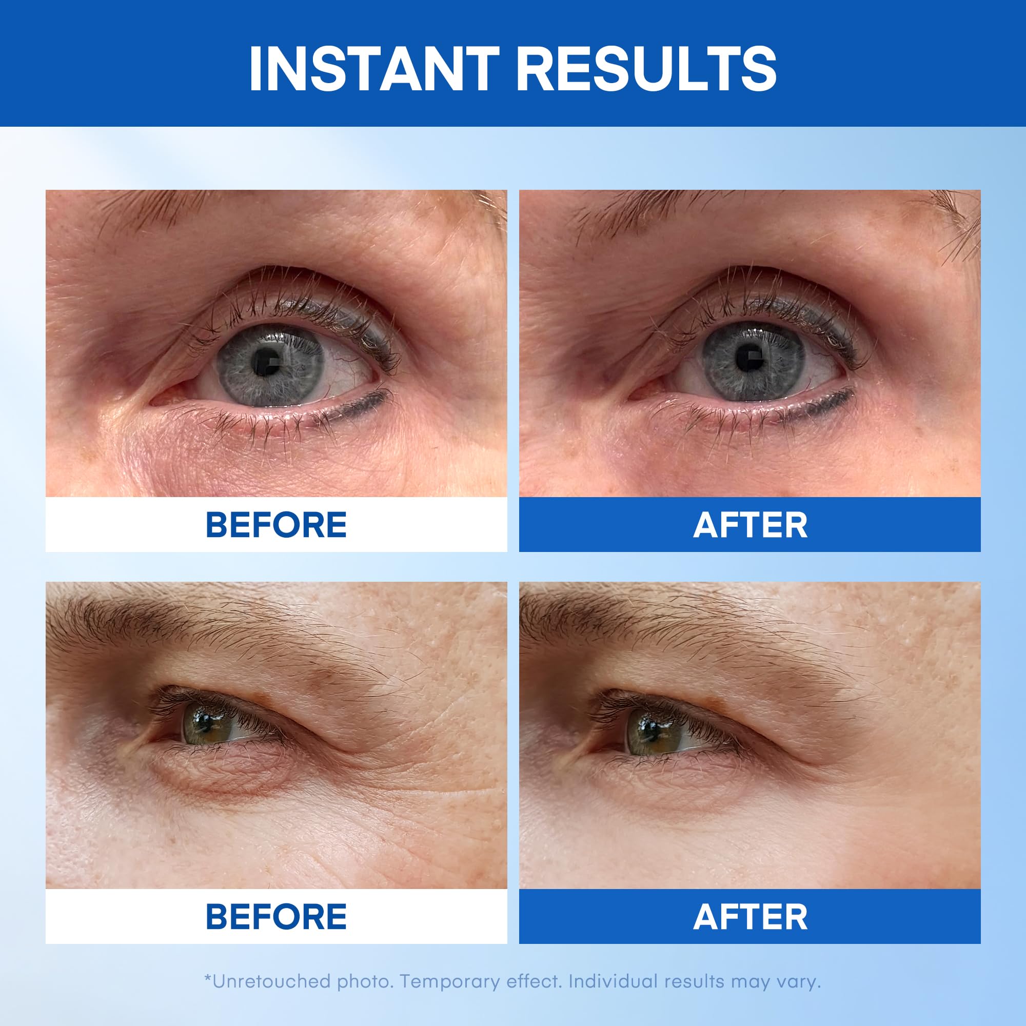 Instant Under Eye Lift Serum in Resealable Tubes